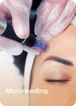 Microneedling