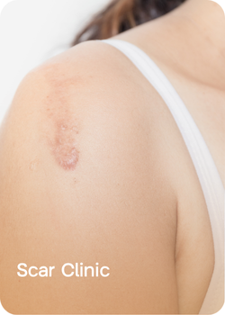 Scar Clinic