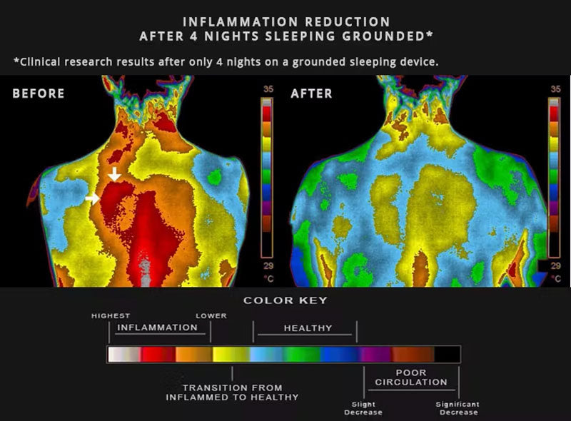 Thermal images of a person's back before and after four nights sleeping grounded, showing less red and orange colour in the after image. Image courtesy of the Earthing Institute.
