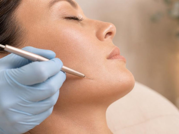Electrolysis hair removal along the jawline