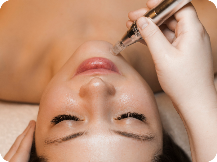 A microneedling facial treatment