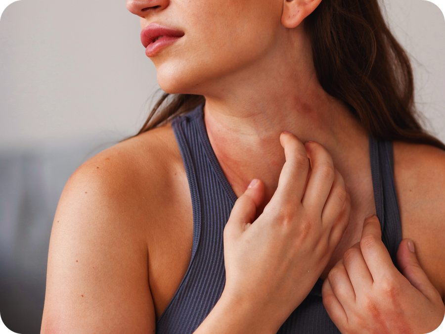 Skin Health, Eczema & Psoriasis